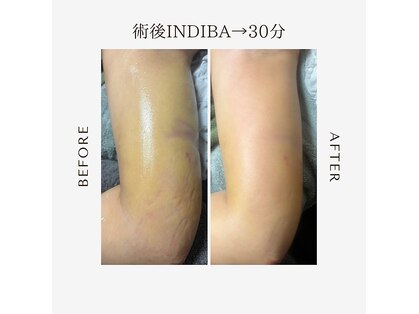 インディバ アンド ルヴィ 沖縄店(INDIBA&REVI)の写真
