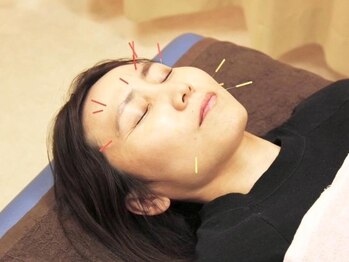 はやしハリきゅう整骨院 本院の写真/【人気店の的確な技術】美容鍼灸でリフトUPとハリツヤが手に入る☆初めての方も◎美容鍼全4コース￥7700～