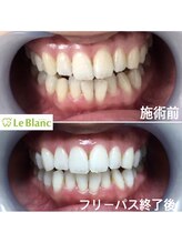 ルブラン 奈良店(Le Blanc)/たったの21日間！短期間で