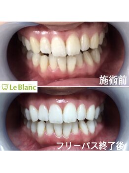 ルブラン 奈良店(Le Blanc)/たったの21日間!短期間で