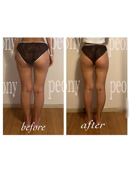 ピオニー(PEONY)/【痩身】美脚スリムコース
