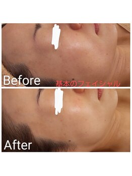 エステティックサロン やまとなでしこ/フェイシャル☆ACトリートメント