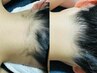 【 レディース脱毛 】 うなじ　¥2500