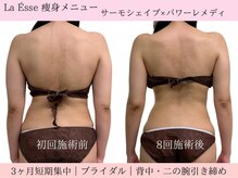 ラエッセ(La Esse)/背中美人は作れます！