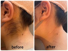 シュガーリングアイムミー(sugaring I'mme)の雰囲気（自分ではお手入れしにくいうなじもこんなに綺麗になります）