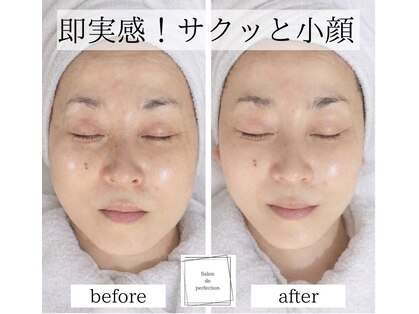サロン ド パーフェクション(Salon de Perfection)の写真