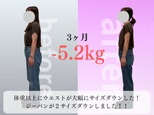 みくる整骨院 美容整体  清須/ダイエット/痩身/肩こり/整体