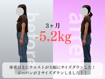 みくる整骨院 美容整体 清須/ダイエット/痩身/肩こり/整体