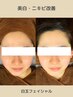 【初夏の日差しに映える発光肌】SNSで超話題☆極上白玉フェイシャル