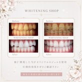 ホワイトニングショップ 札幌(Whitening Shop)