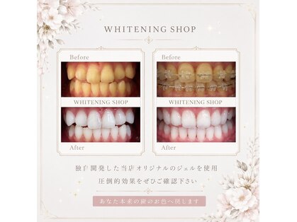 ホワイトニングショップ 札幌(Whitening Shop)の写真