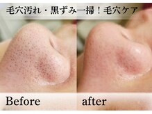 アナシアビューティーサロン(Anacia)
