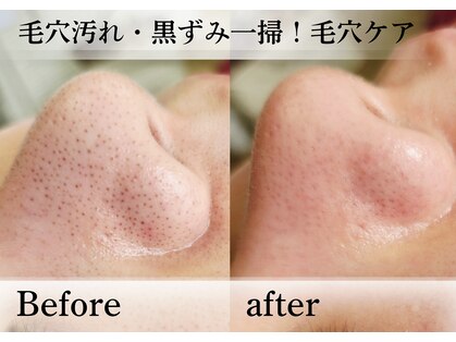 アナシアビューティーサロン(Anacia)の写真