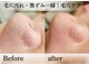 アナシアビューティーサロン(Anacia)の写真