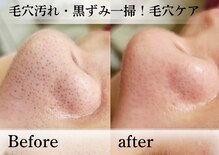 アナシアビューティーサロン(Anacia)