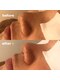 エクラ 長崎(ECLAT)の写真/【繰り返す肌トラブルに】こだわり商材と技術で肌質改善◎内側から発光するような潤いツヤ肌へ！長崎/小顔