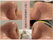 ラボーテアッシュ(La beaute H)の雰囲気(1回でも効果実感☆毛穴悩みも解消☆)