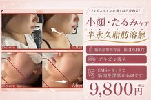 ウィンウィン 新山口店(Win Win)