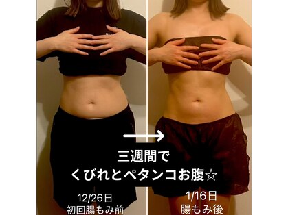 ベラの写真