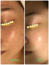 マハロ(mahalo)/NMN配合エルモサハーブで肌育成