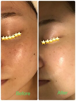 マハロ(mahalo)/NMN配合エルモサハーブで肌育成