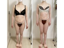 蒼(so)/寝ながら全身バランス矯正