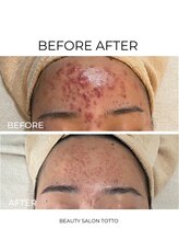 トット 恵比寿(totto)/ケア症例