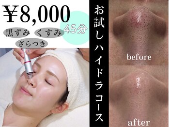 リンフェイス 高松店(LINFACE)