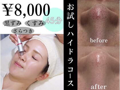リンフェイス 高松店(LINFACE)の写真
