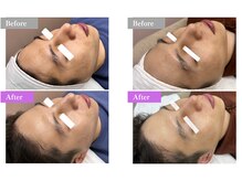 ホワイトワックス 新宿店(WHITE WAX)/☆BeforeAfter☆