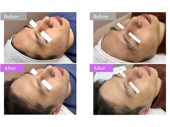 ホワイトワックス 新宿店(WHITE WAX)/☆BeforeAfter☆