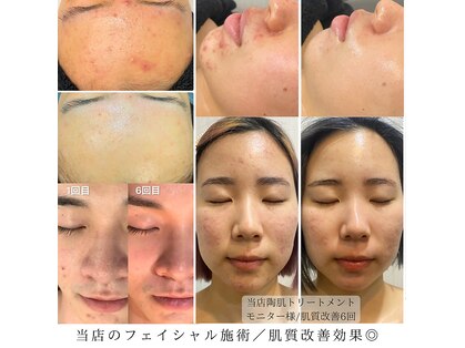 サロン ド ボーテル ヴィ(salon de beaute REVI)の写真