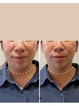 サロン モジョ(mojo)/リフティング