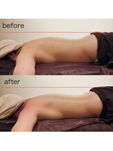 ベレーザ(Beleza.)/反り腰がやわらぐ