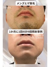 マウム(Maum)/清潔感溢れる肌へ