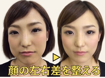 ナチュラルパーフェクトフェイス 新宿の写真/【結果重視の小顔矯正】小顔だけでなく、すっきりフェイスライン＋左右差バランスを整えナチュラル美顔に◎