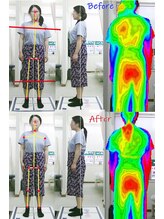 姫路なごみ整体院 なごみ鍼灸院/【改善例】左腰～臀部の慢性痛