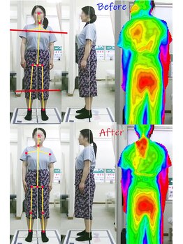 姫路なごみ整体院 なごみ鍼灸院/【改善例】左腰~臀部の慢性痛