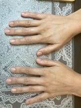桃の木 吉祥寺店/だんだん健康な爪になっています