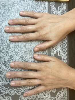 桃の木 吉祥寺店/だんだん健康な爪になっています