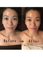 グレースフィオーレ 上野御徒町店(gracefiore)/ビフォーアフター