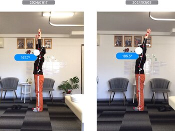 ナオル整体 池尻大橋院(NAORU整体)/50肩の改善!!<50代女性>