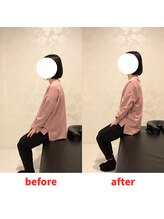 ナオル整体 福岡香椎院(NAORU整体)/30代女性施術事例【猫背】