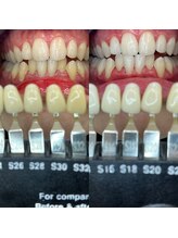 トウキョースワーズ 渋谷店(TOKYO SWRS)/#ホワイトニング #渋谷 #池袋