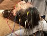 【人気NO.1】電気美容鍼+首肩マッサージ+ヒト幹細胞ミスト♪最強リフトアップ