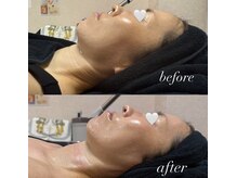 マヤヒメ(mayahime)/輪郭スッキリ