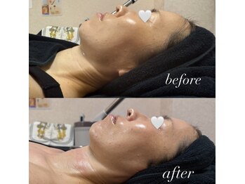 マヤヒメ(mayahime)/輪郭スッキリ