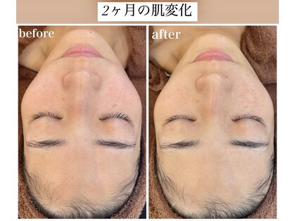 アプリ(APRI)の写真