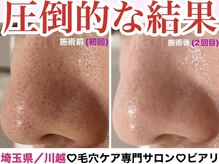 ビアリ(Biarri)の雰囲気（施術だけではなくご自宅でのケア方法もお伝えさせて頂きます。）
