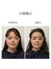 【平日10～15時限定】ヘッドスパor小顔&首肩・背中ケア60分　初回50％オフ